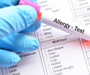 Gıda alerjisi belirtileri nelerdir?